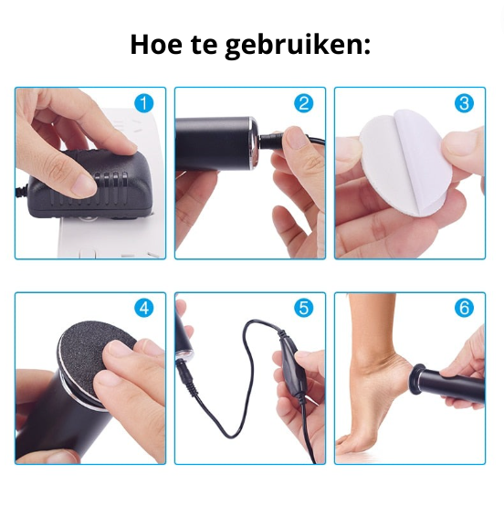 Smoothfeet - Elektrisches Fußpflegegerät zur Kallusentfernung, USB-wiederaufladbar-6
