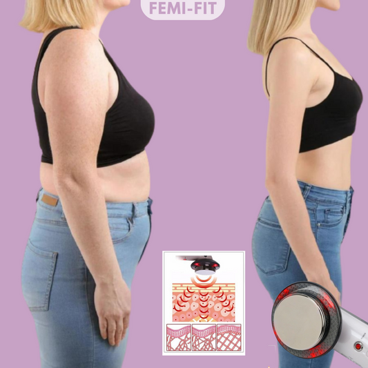 SlimShape - 3-in-1 Cellulite- und Fettbrenner mit EMS, Ultraschall und Infrarotlicht-1
